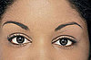 Eyebrow Transplants Offer Solutions For Overplucking