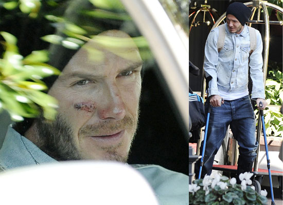 Photos of David Beckham on Crutches in Milan Photos of David Beckham on Crutches in Milan