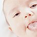 There are risks to circumcision
