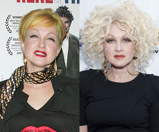 Cyndi Lauper