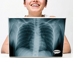 X-Ray Laptop Skin X-Ray Laptop Skin