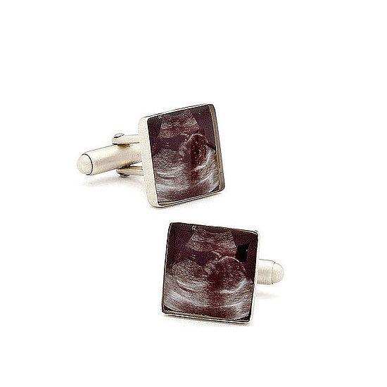 Sonogram Cufflinks: Cute or Creepy? Sonogram Cufflinks: Cute or Creepy?
