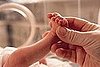 World's Earliest Preemie