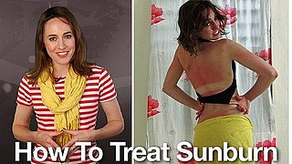 How to Treat Sunburn: Remedies and Tips on Treating Sunburn