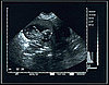 BirthorNot.com Is Fake