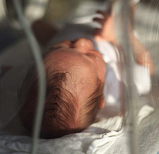 Dads Who Decide to Circumcise Sons