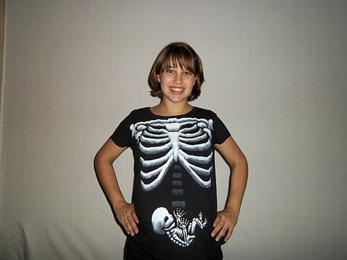 X-Ray Baby Belly X-Ray Baby Belly