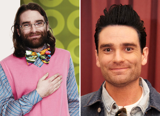 Jimmy: Before and After Jimmy: Before and After