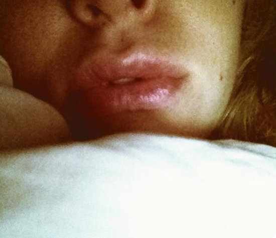 Lips Lips