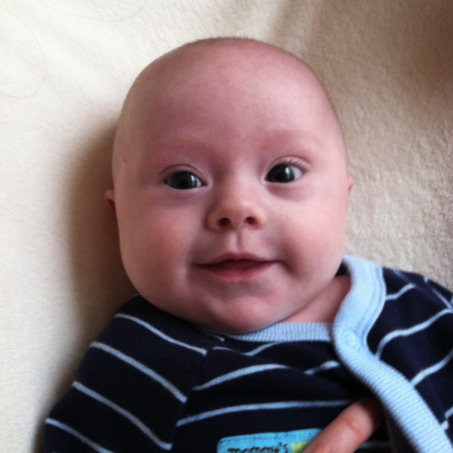Raising a Child With Down Syndrome