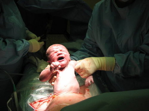 Did you forego a VBAC for an elective second C-section? Did you forego a VBAC for an elective second C-section?