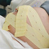 Risky Pregnancy Procedures