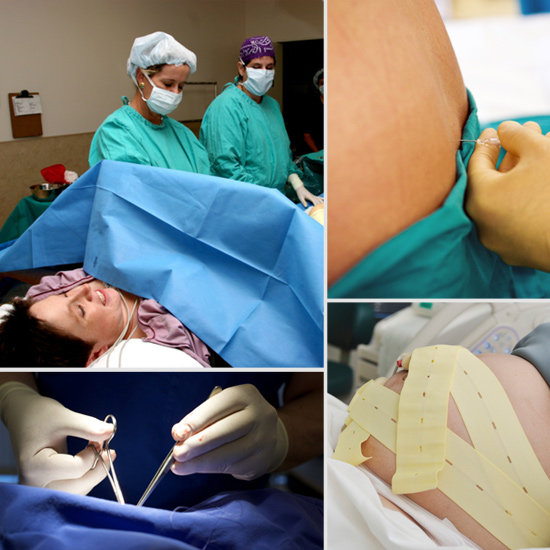 Did You Engage in Any of These Risky Pregnancy Procedures? Did You Engage in Any of These Risky Pregnancy Procedures?