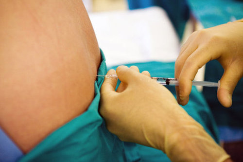 How soon did you have an epidural? How soon did you have an epidural?