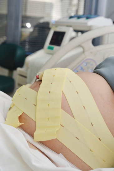 Were you hooked up to continuous electronic fetal monitoring? Were you hooked up to continuous electronic fetal monitoring?