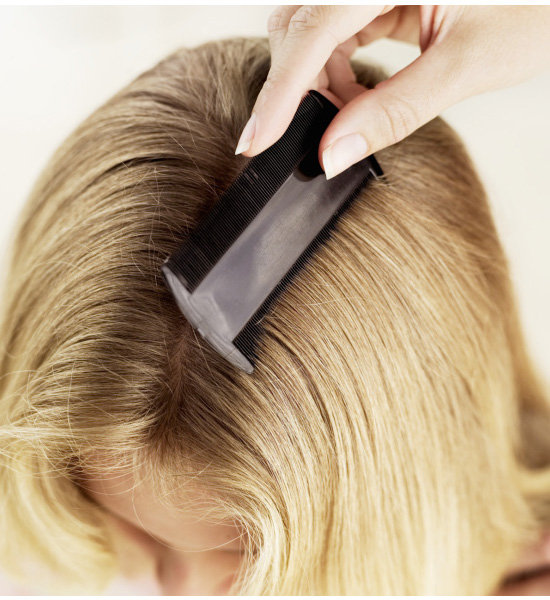 7 Tips For Combatting Lice 7 Tips For Combatting Lice