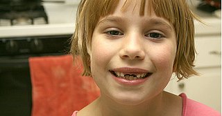 5 Winning Tips for Losing Teeth