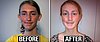 Non-Profit Provides Free Plastic Surgery to Kids Bullied Over Their Looks (VIDEO)