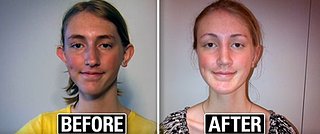 Non-Profit Provides Free Plastic Surgery to Kids Bullied Over Their Looks (VIDEO)