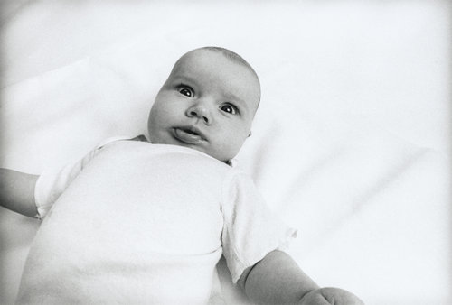 Moro Reflex Moro Reflex