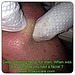 Facial Extraction 