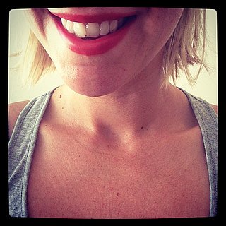 Invisalign Review and Does Invisalign Work?