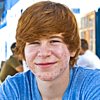 Teen Acne Treatments