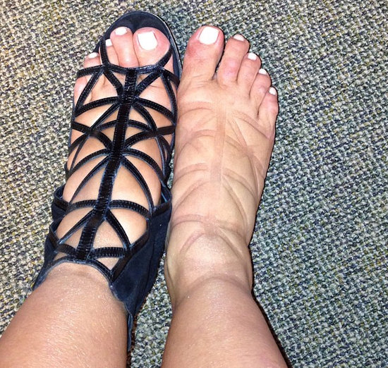 Feet Feet