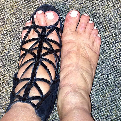 Pregnancy Swelling in 8 Weird Places