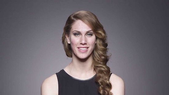 How One Woman Overcame Her Struggle With Acne to Become a Model How One Woman Overcame Her Struggle With Acne to Become a Model