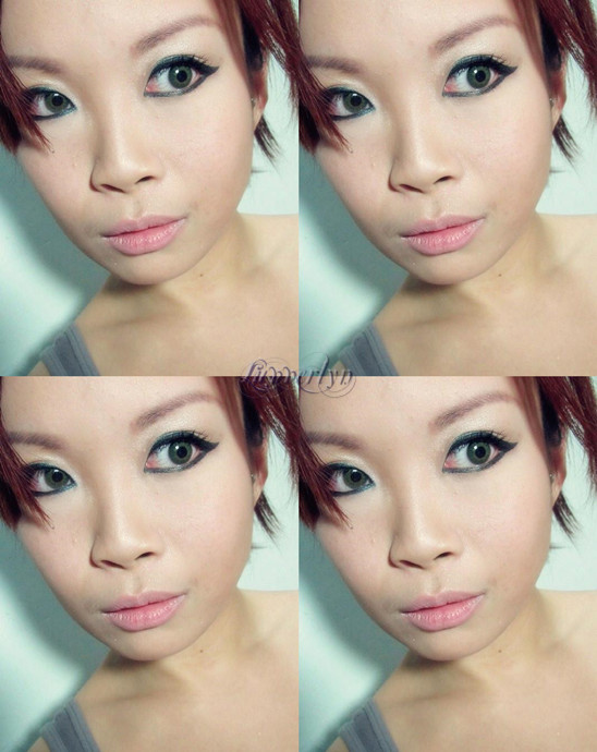 scarless double eyelid surgery