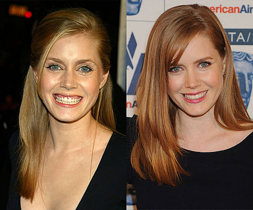 Amy Adams Amy Adams