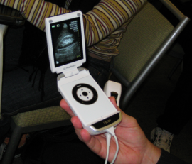GE Introduces New Portable Ultrasound Device