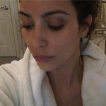 Kim's Black Eye, Rob & Kristen in Bed, & NPH Ditching Acting?