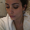 Kim's Black Eye, Rob & Kristen in Bed, & NPH Ditching Acting?