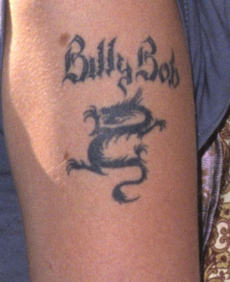 Tattoo Removal: The Stats Are Surprising