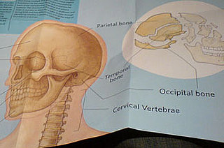 Occipital Bone  