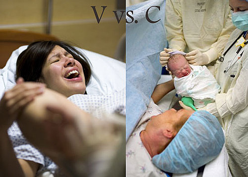 Vaginal Versus C-Section Birth