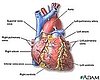 Michael Jackson and the Difference Between Sudden Cardiac Arrest and Heart Attack