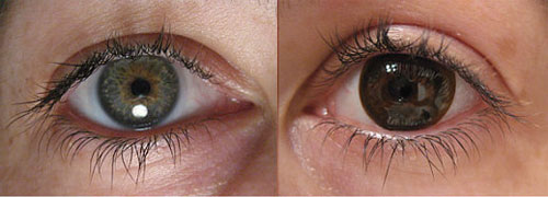 Wear Contact Lenses? Keep These in Mind