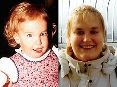 Video of Kate Kane on Good Morning America Discussing Her Struggle With Prader-Willi Syndrome Video of Kate Kane on Good Morning America Discussing Her Struggle With Prader-Willi Syndrome