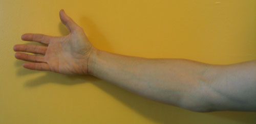 Why Are Veins Blue If Blood Is Red? Why Are Veins Blue If Blood Is Red?