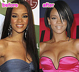 Did Rihanna Get Breast Implants?