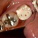 Kitty Tooth Bling