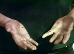 "Germs and You": A PSA "Germs and You": A PSA