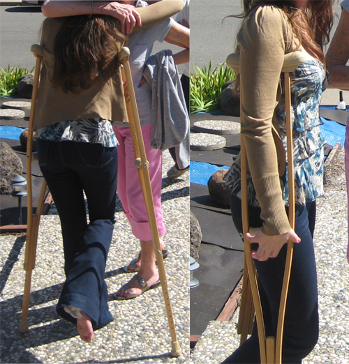 The Easter Crutches Blues