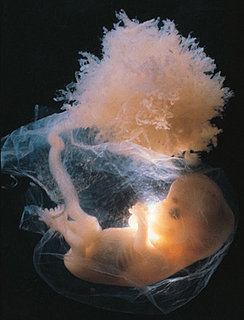 Illegal to Implant an Embryo with a Genetic Abnormality?