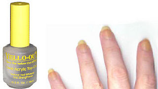yellow nails