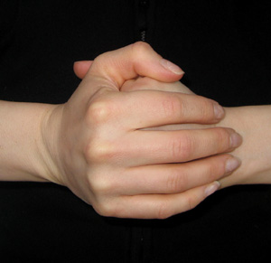 You Asked: Does Cracking Your Knuckles Cause Joint Damage? 