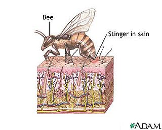 When Was the Last Time You Were Stung by a Bee?